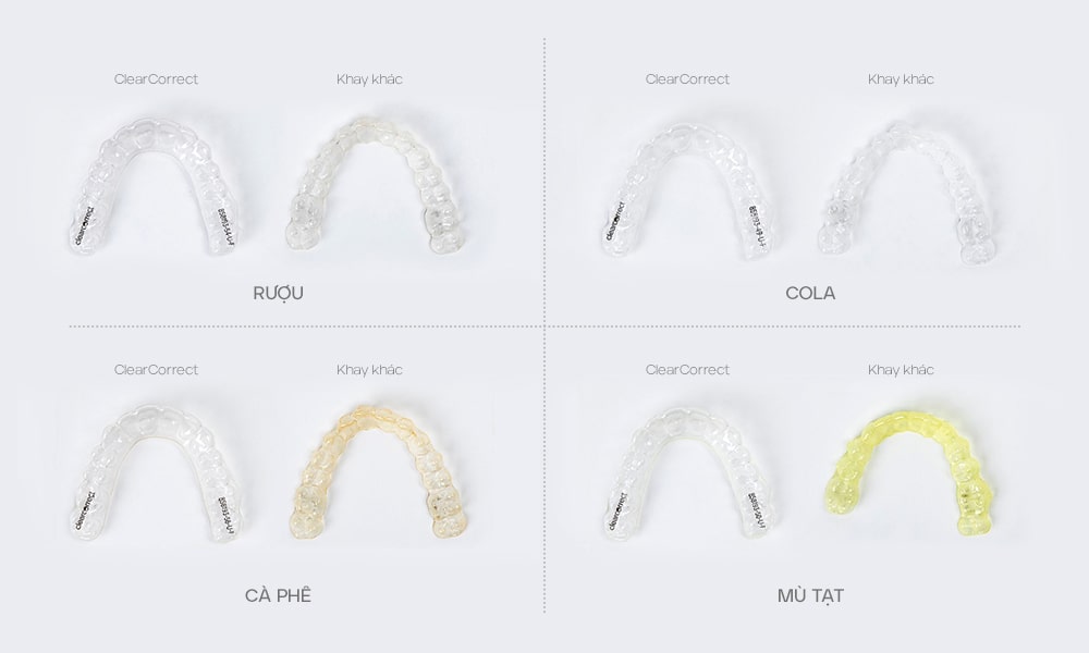 So sánh khay Clearcorrect với khay thông thường