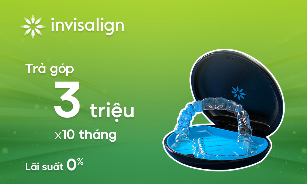Trả góp khi niềng khay Invisalign 