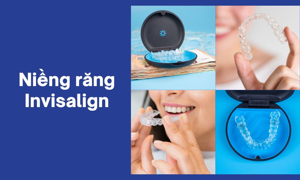 niềng răng invisalign