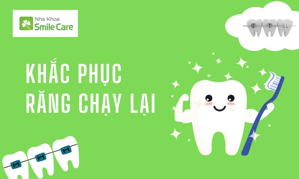Cách khắc phục cho tình trạng răng chạy lại sau niềng?