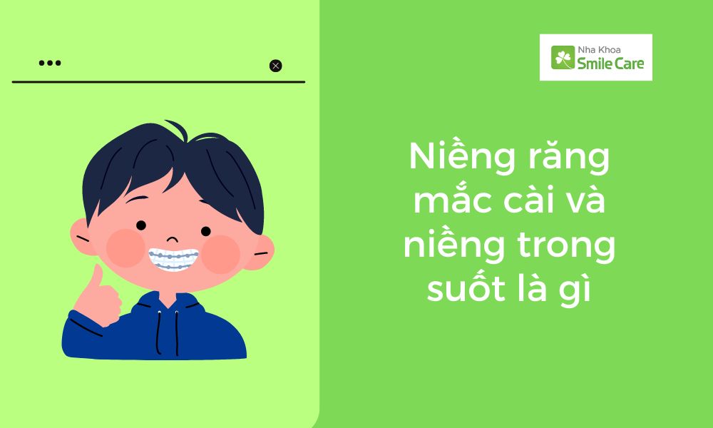 Niềng răng mắc cài và niềng răng trong suốt là gì?