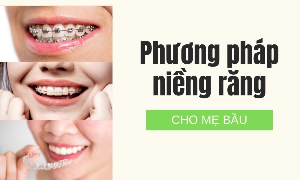 Phương pháp niềng răng cho mẹ bầu