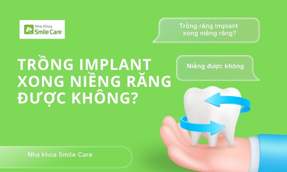 Trồng răng Implant có niềng răng được không?