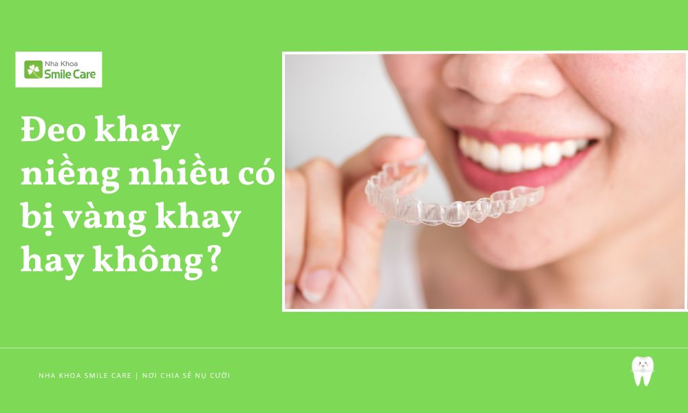 Khay niềng trong suốt bị ố vàng do đeo nhiều?