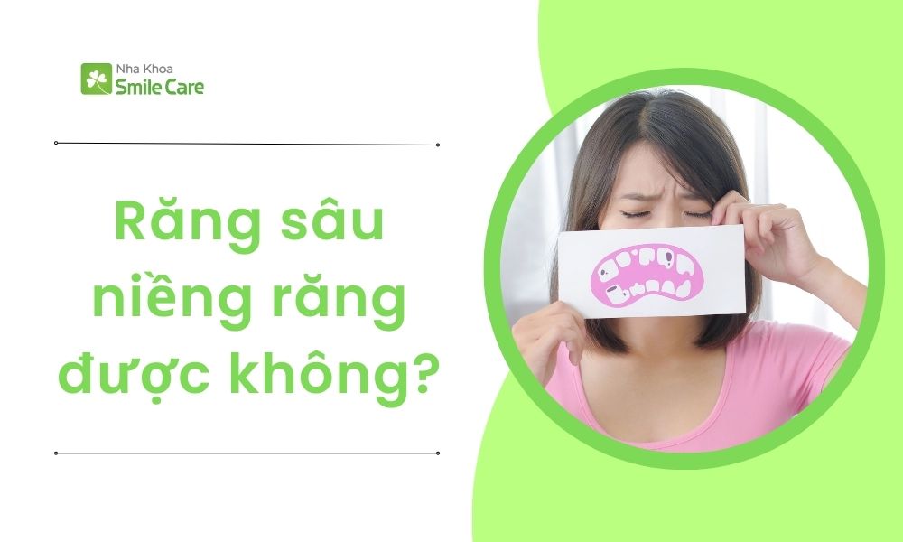 Sâu răng có niềng răng được không?