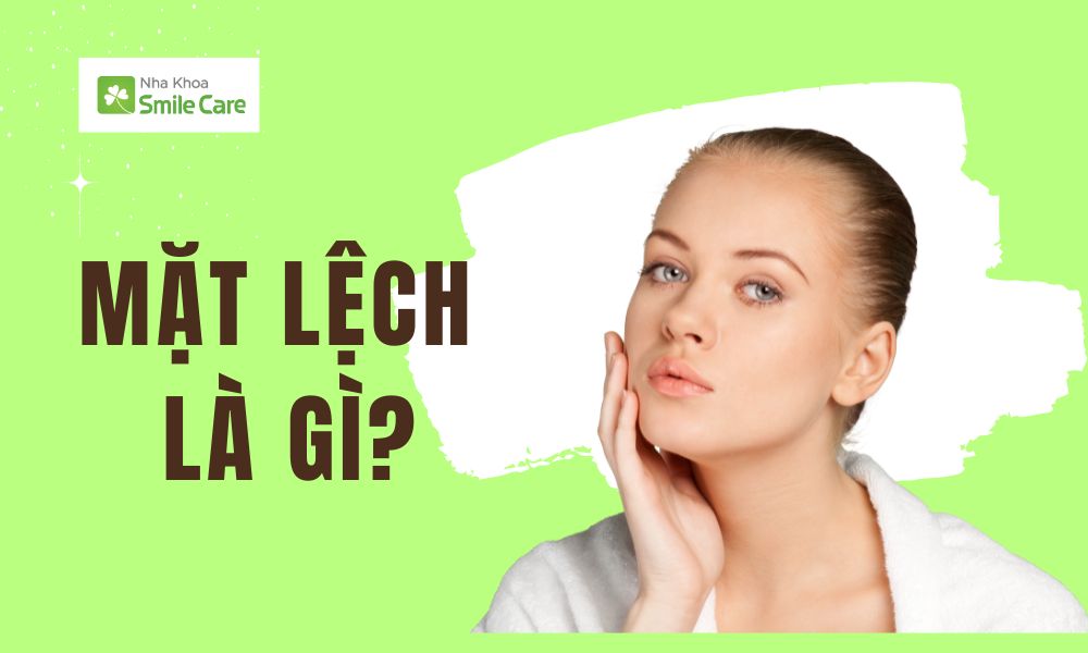 Mặt lệch là gì?