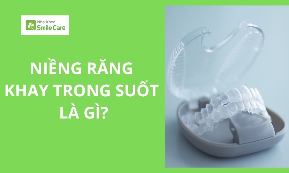 Niềng răng trong suốt là gì?