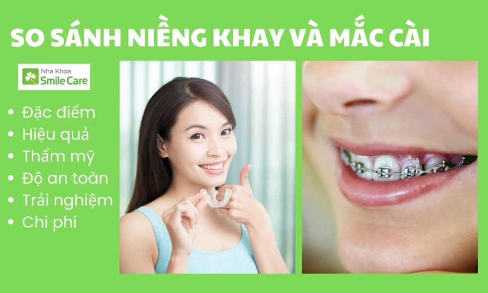So sánh niềng răng trong suốt và mắc cài?