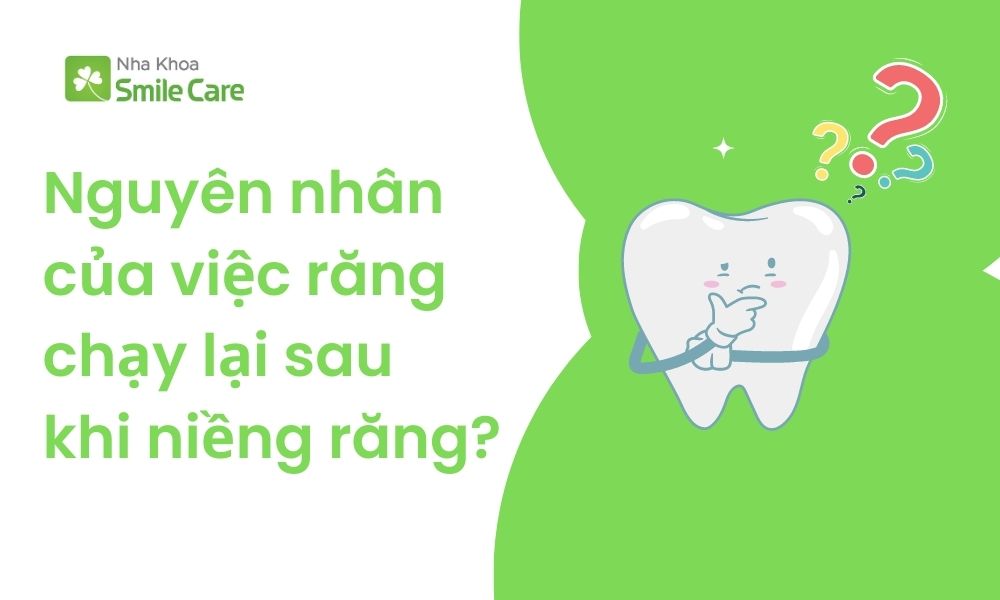Nguyên nhân của việc răng chạy lại sau niềng?