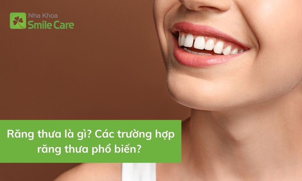 Răng thưa là gì