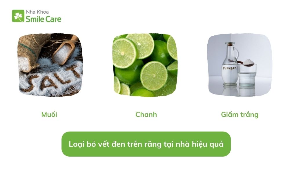 Loại bỏ vết đen trên răng 