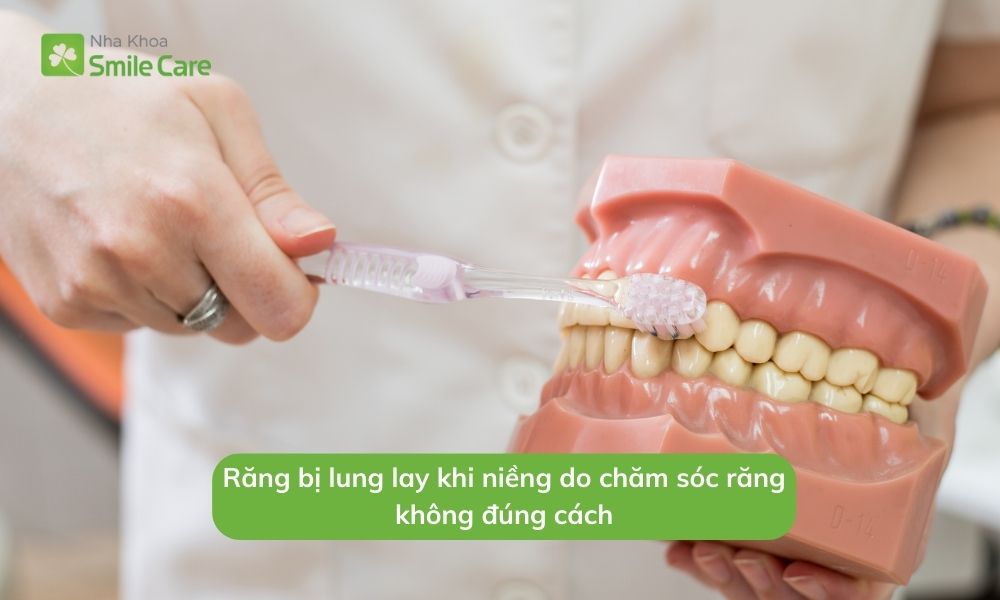 Răng bị lung lay khi niềng