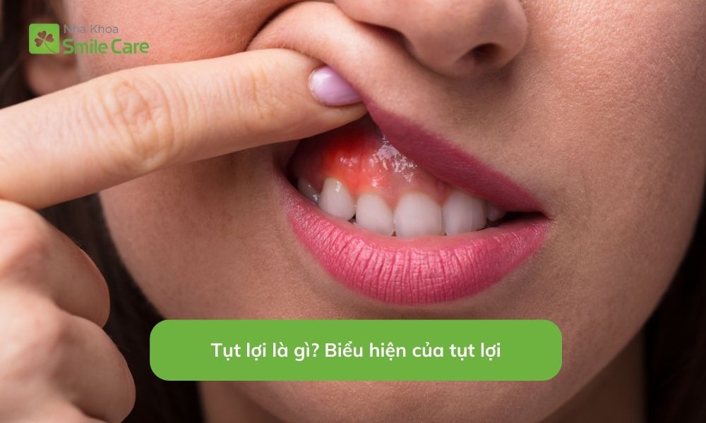 Biểu hiện của tụt lợi