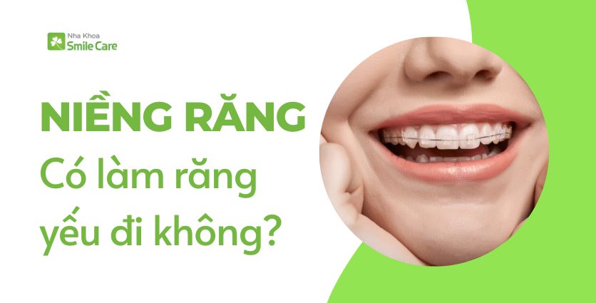 Niềng răng có làm răng yếu đi không?