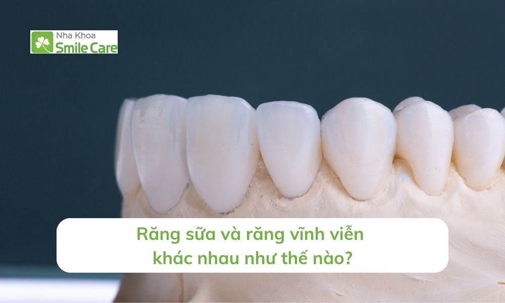 Răng sữa và răng vĩnh viễn khác nhau 