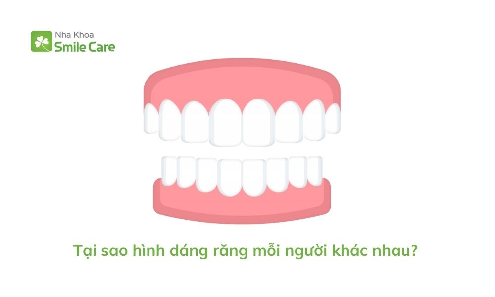 hình dáng răng mỗi người khác nhau? 