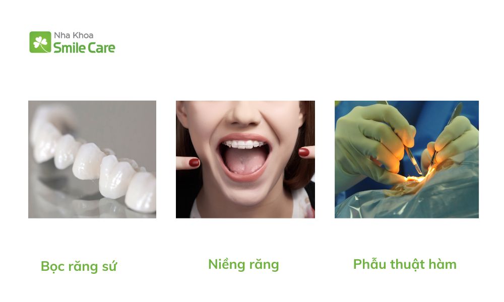 khắc phục tình trạng răng móm hiệu quả