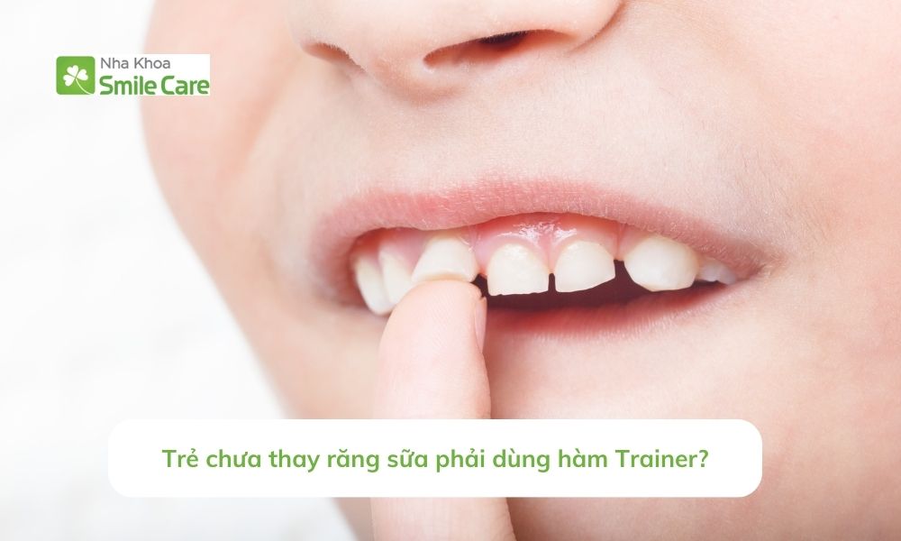 Trẻ chưa thay răng sữa dùng hàm Trainer?