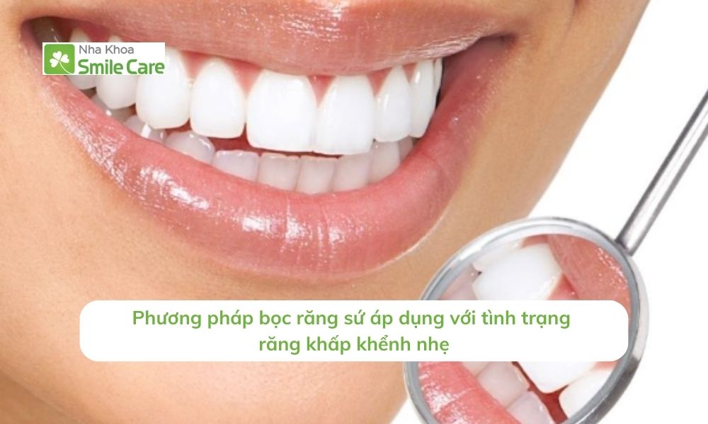Phương pháp bọc răng sứ