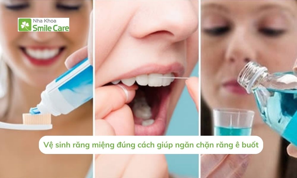  ngăn chặn răng ê buốt
