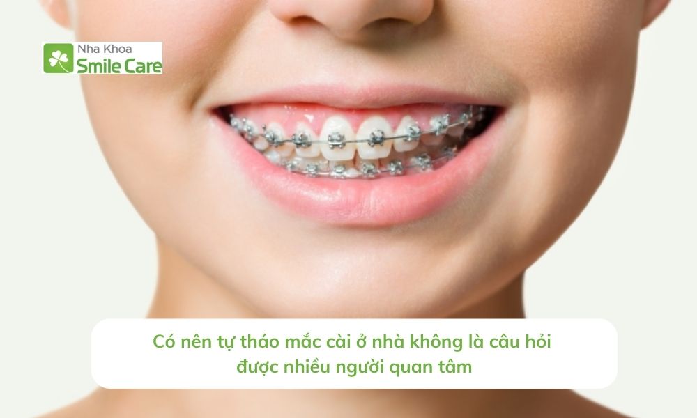 Có nên tự tháo mắc cài ở nhà không 