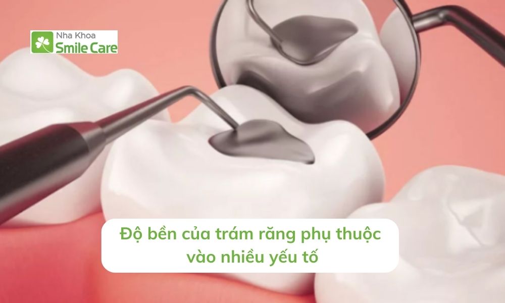 Độ bền của trám răng phụ thuộc vào nhiều yếu tố khác nhau