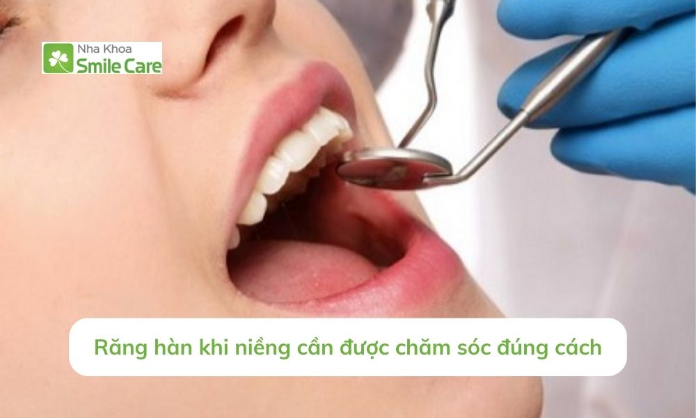 Răng hàn khi niềng cần chăm sóc đúng cách