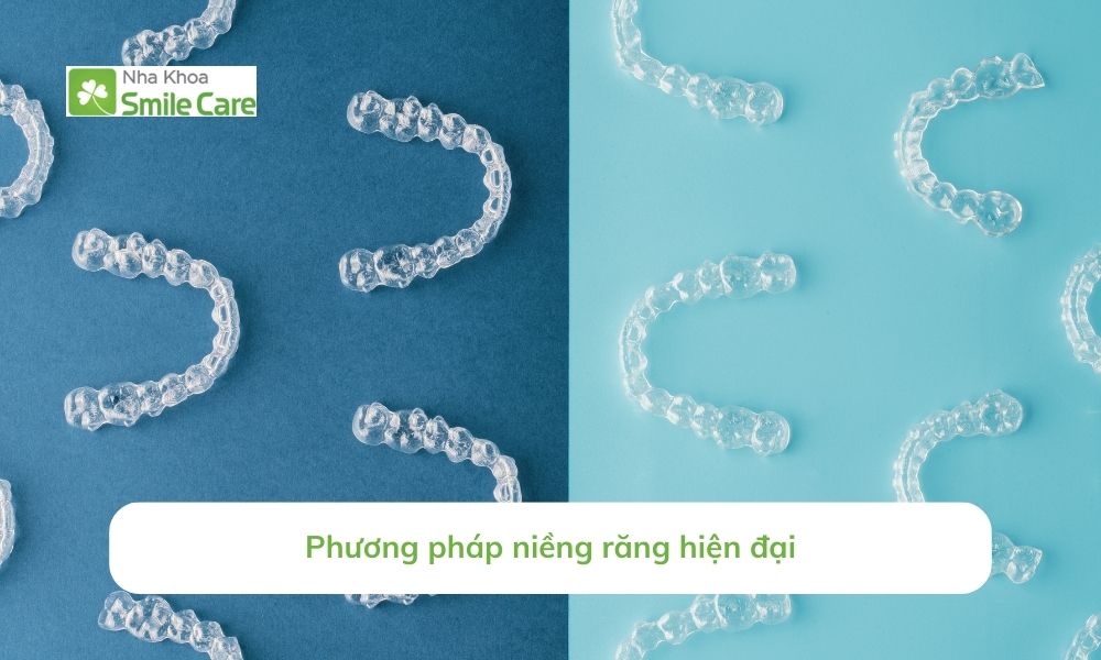 Phương pháp niềng răng hiện đại