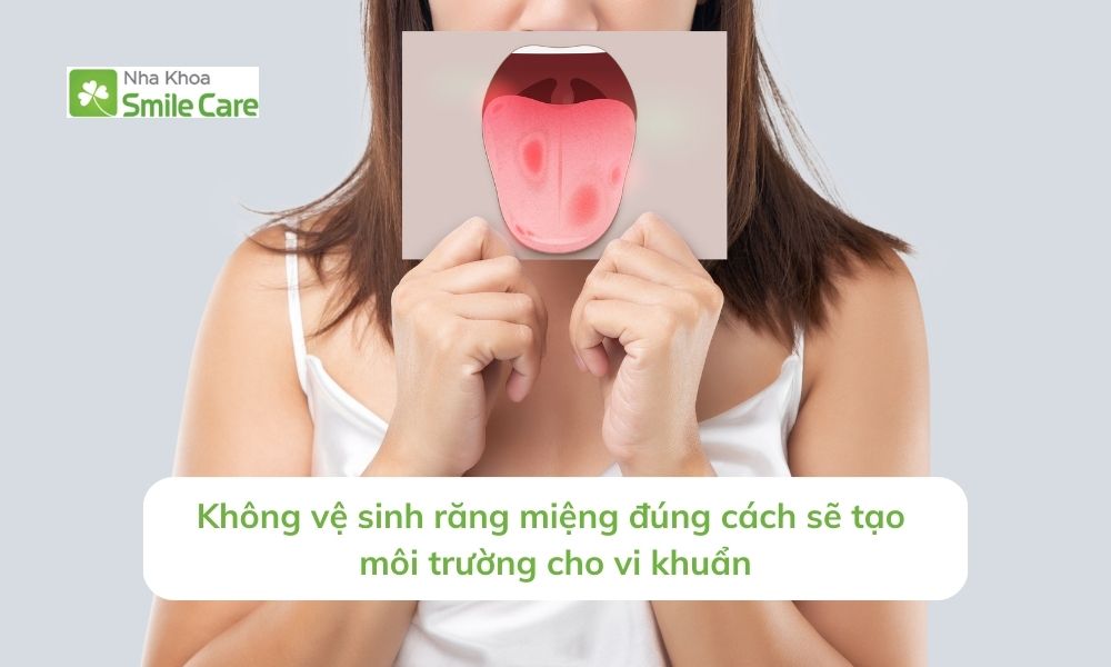 Không vệ sinh răng miệng đúng cách tạo môi trường cho vi khuẩn