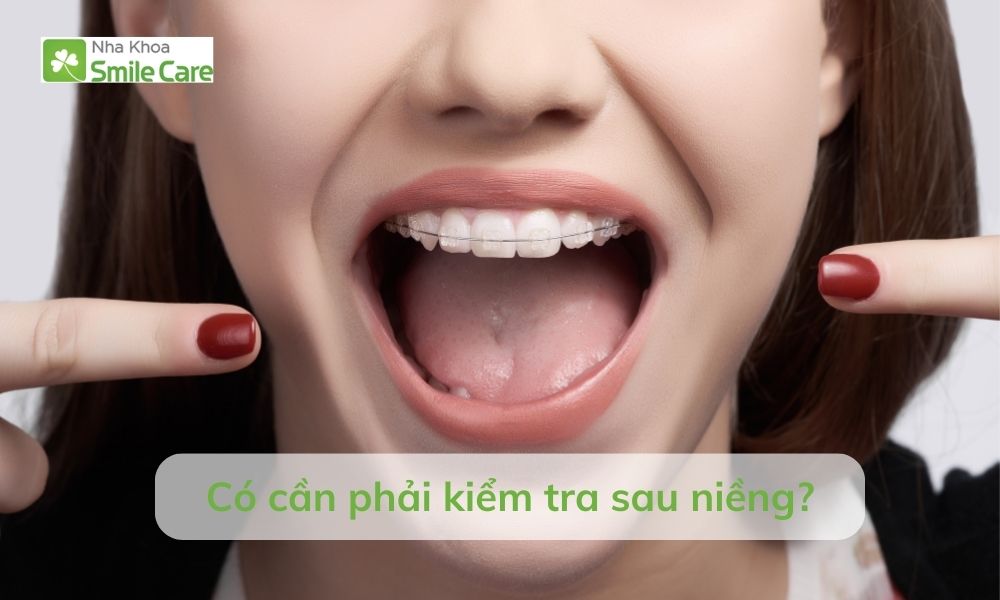 Có phải kiểm tra sau niềng
