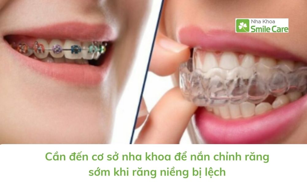 Cần đến cơ sở nha khoa để nắn chỉnh răng khi răng niềng bị lệch