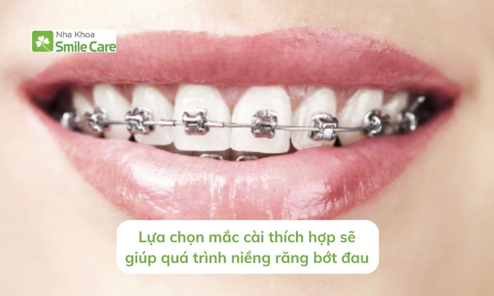Lựa chọn mắc cài thích hợp sẽ giúp niềng răng bớt đau.