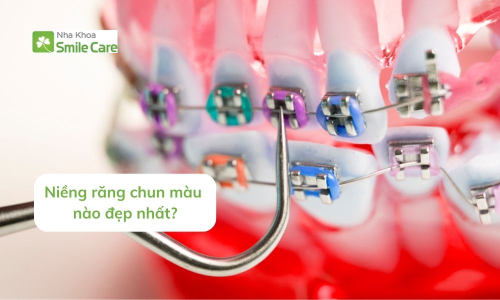 chun màu nào đẹp nhất?