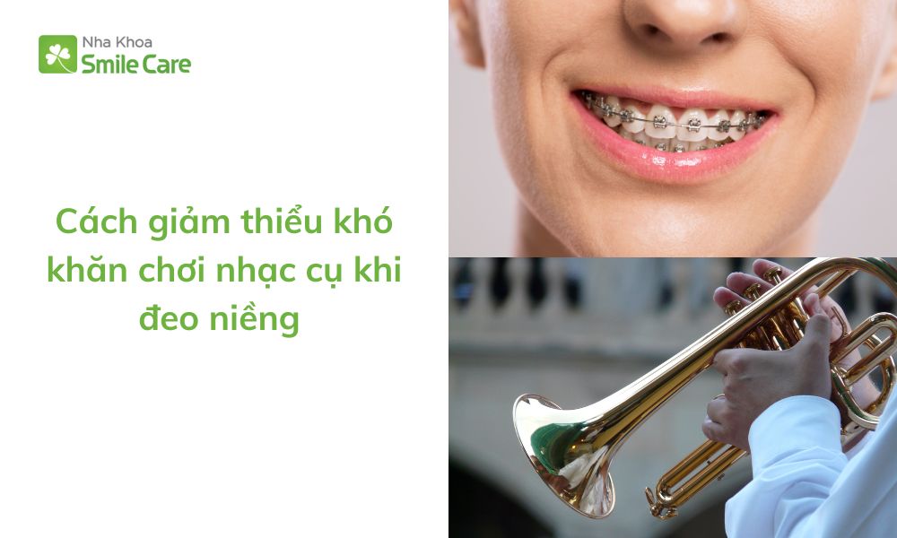 chơi nhạc cụ khi đeo niềng