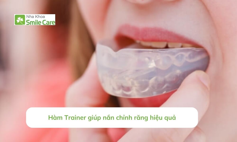 Hàm Trainer chỉnh nha