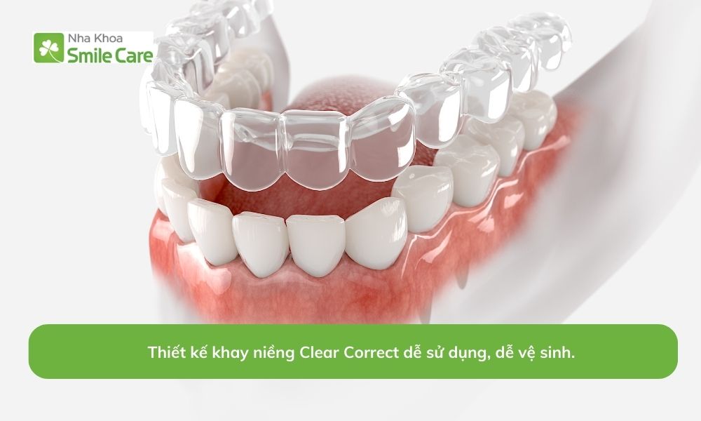 Thiết kế khay niềng Clear Correct