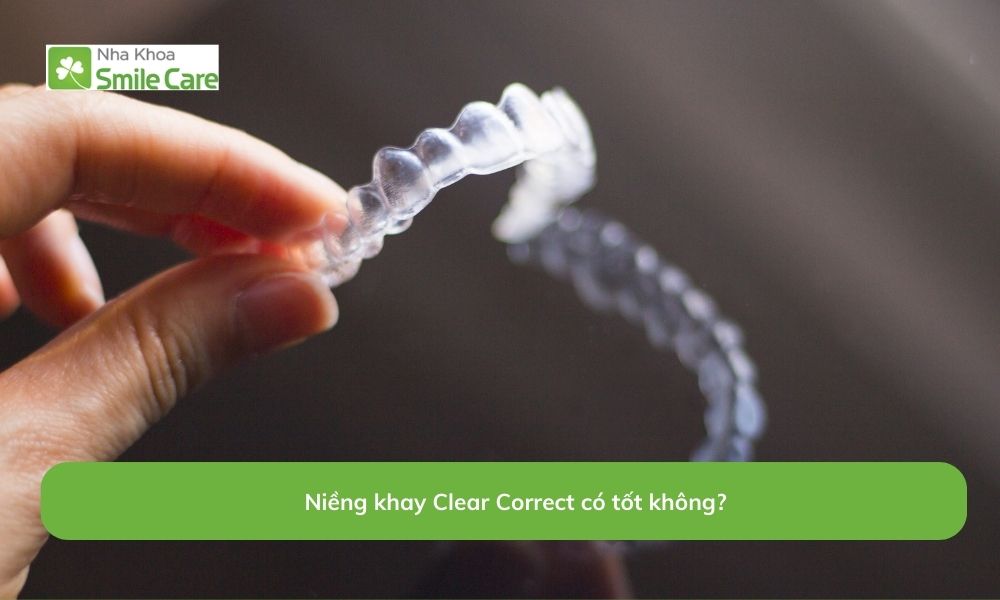Niềng Clear Correct có tốt không?