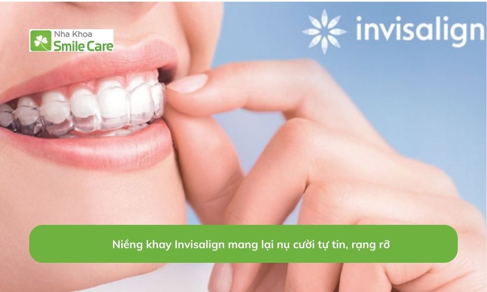 Niềng khay Invisalign mang lại nụ cười tự tin