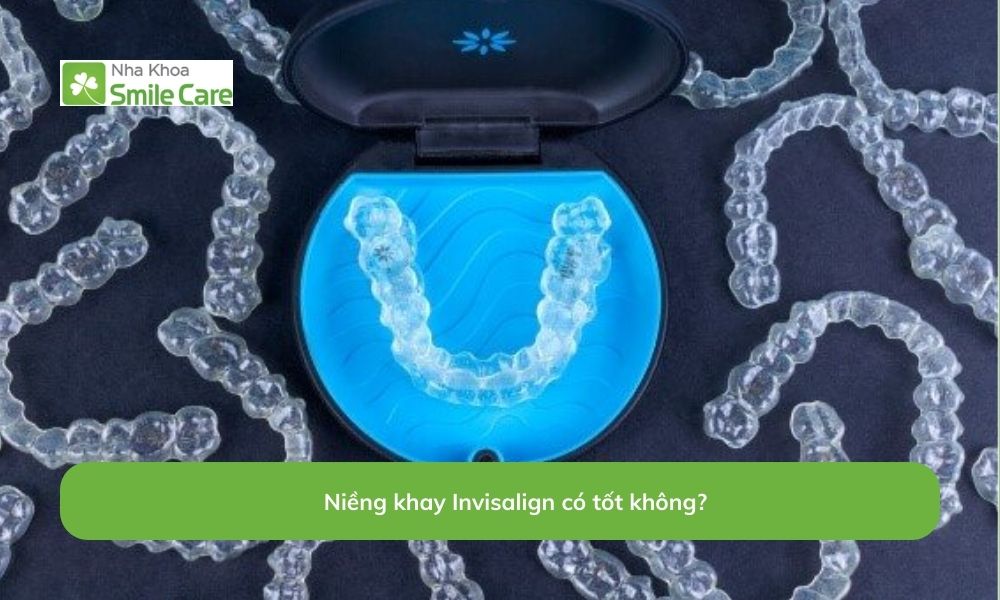Niềng khay Invisalign 
