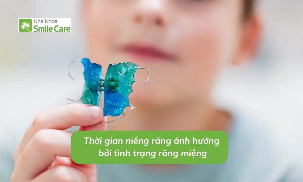 Thời gian niềng răng ảnh hưởng bởi tình trạng răng miệng.