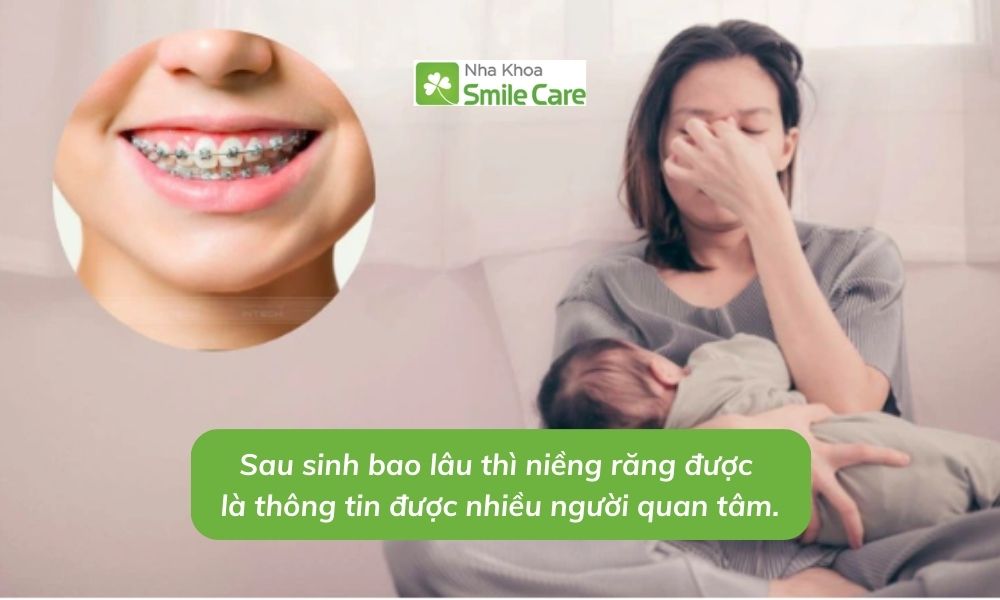 Sau sinh bao lâu thì niềng răng được được nhiều người quan tâm.