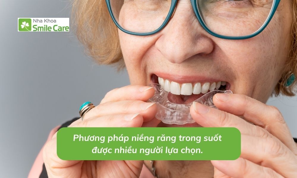 Phương pháp niềng răng trong suốt được nhiều người chọn.