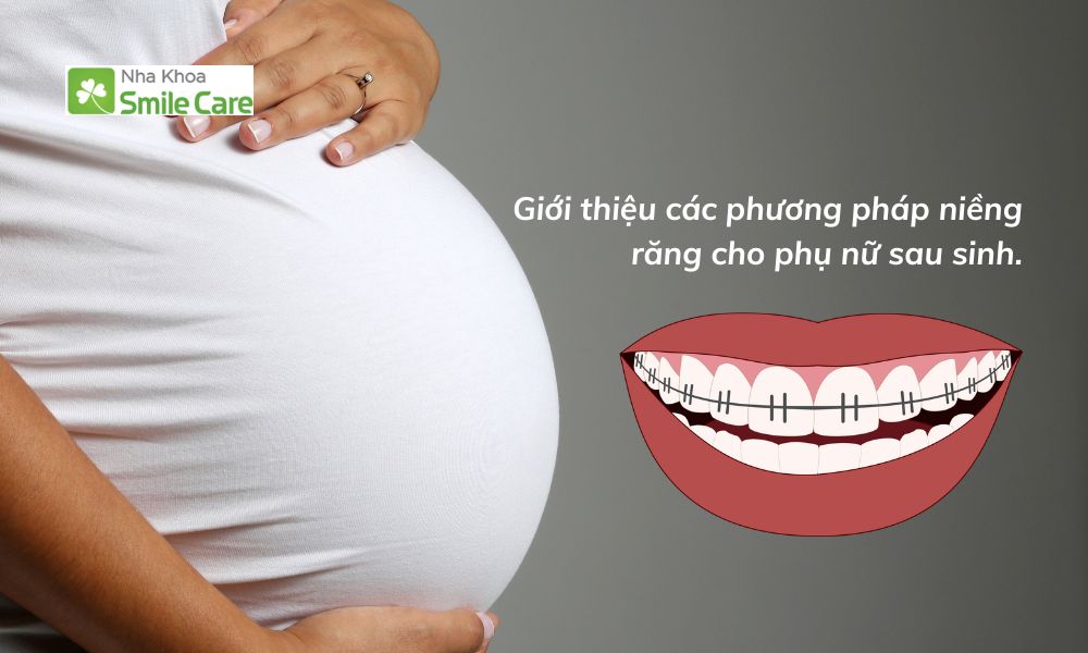 Các phương pháp niềng răng cho phụ nữ sau sinh