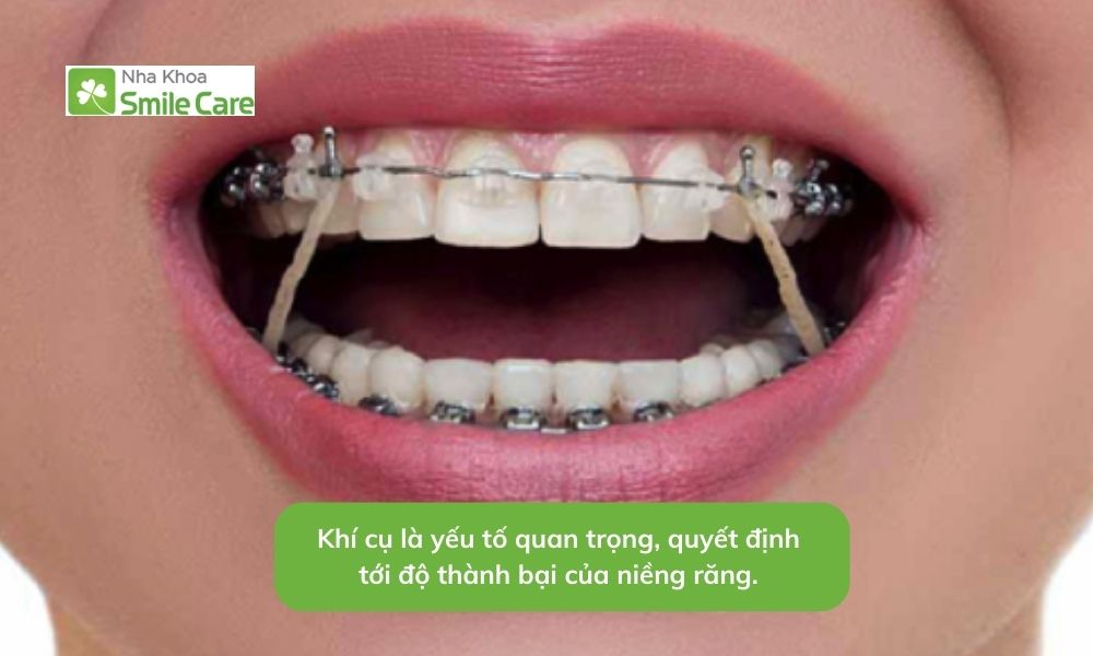 Khí cụ là yếu tố quan trọng, quyết định tới độ thành bại của chỉnh nha