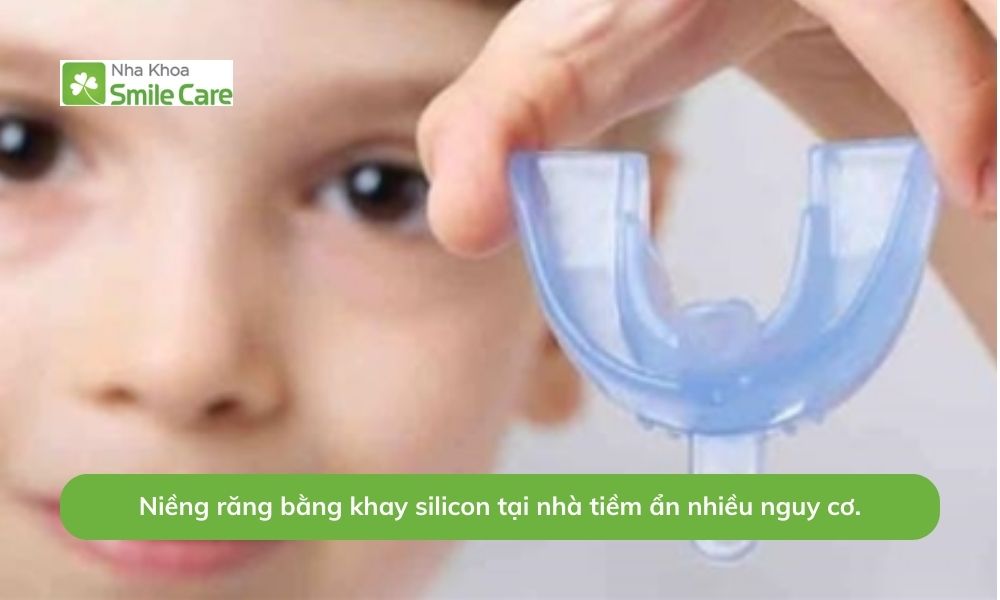 Niềng răng bằng khay silicon tại nhà tiềm ẩn nhiều nguy cơ