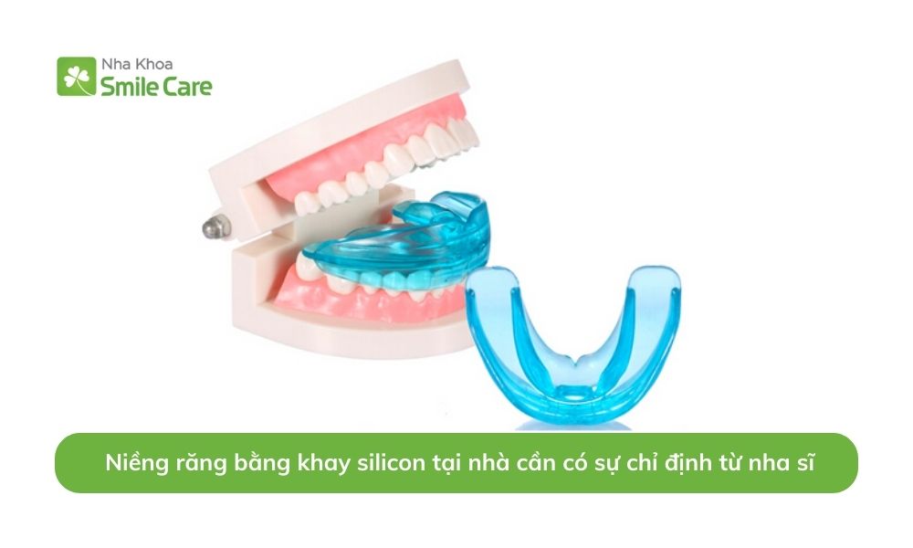  Niềng răng bằng khay silicon tại nhà cần có sự chỉ định từ nha sĩ