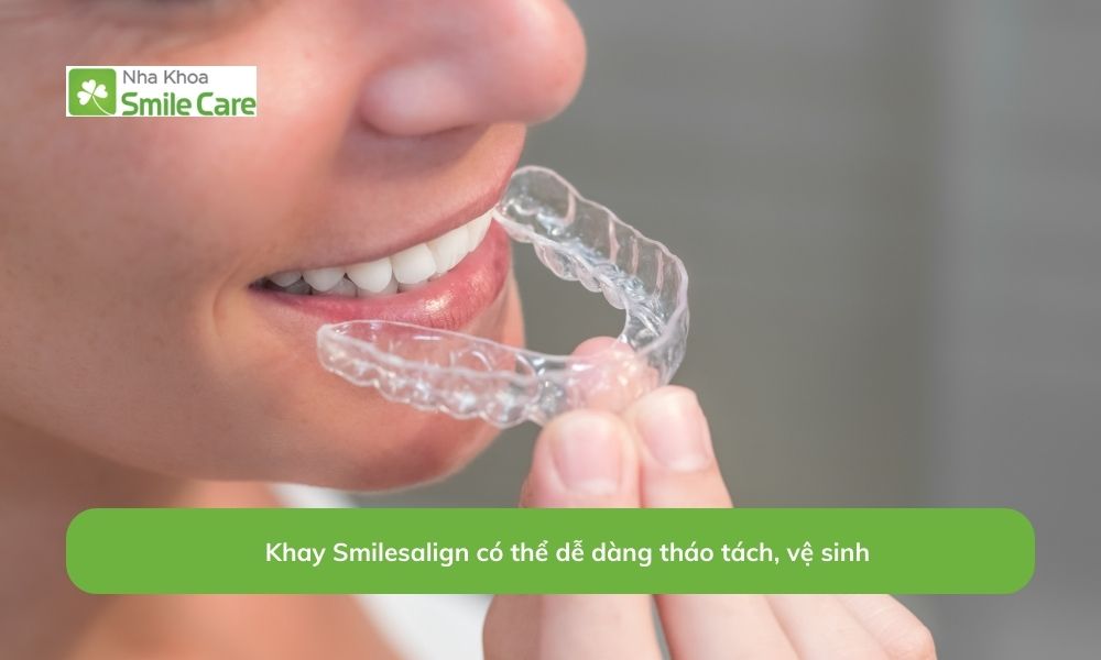 Khay Smilesalign có thể dễ dàng tháo tách và vệ sinh