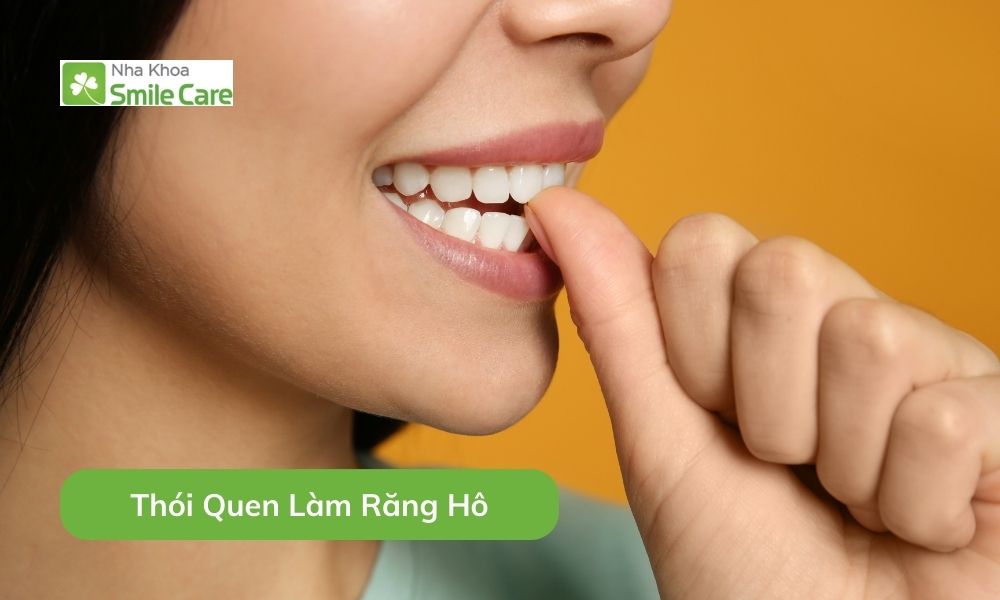 Thói Quen Răng Hô