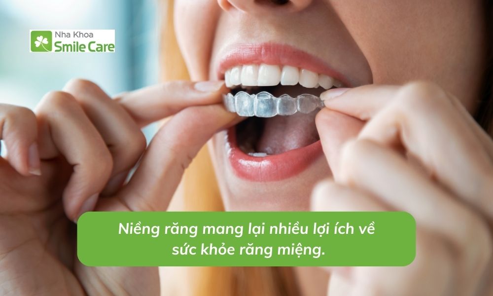 Niềng răng mang lại nhiều lợi ích sức khỏe răng miệng.