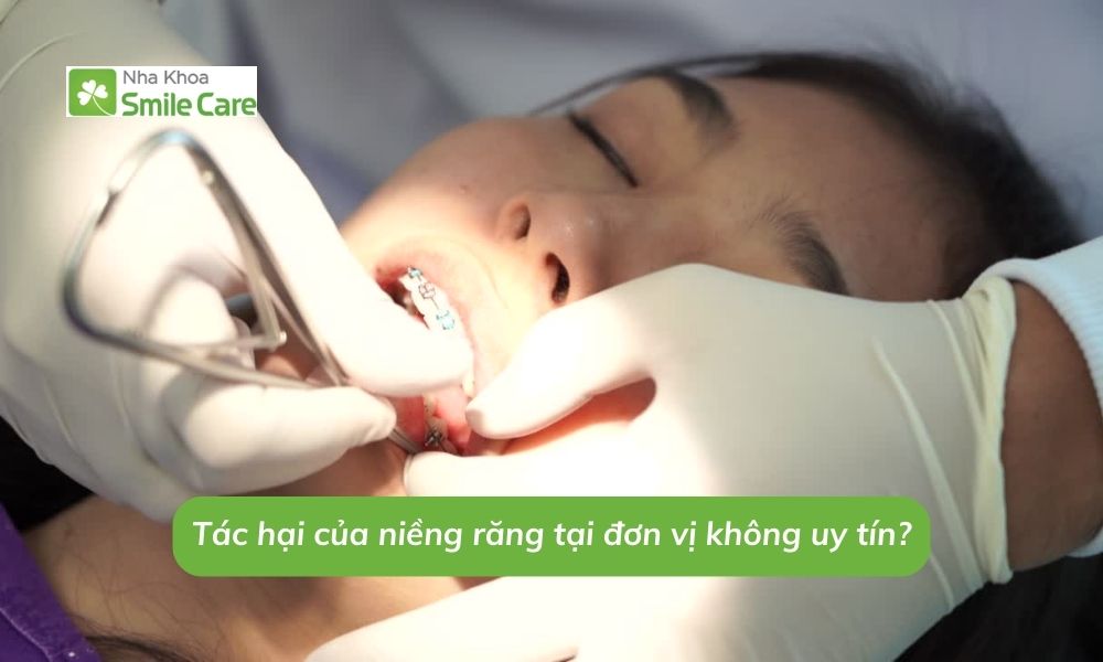 Tác hại của niềng răng tại đơn vị không uy tín